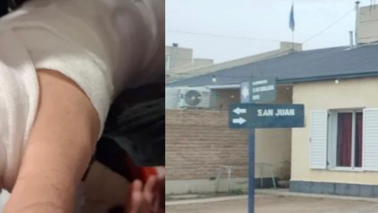 Brutal ataque de dos dogos a un adolescente: "Lo mordieron hasta en la cabeza, si no intervenía el vecino con un caño, me lo mataban"