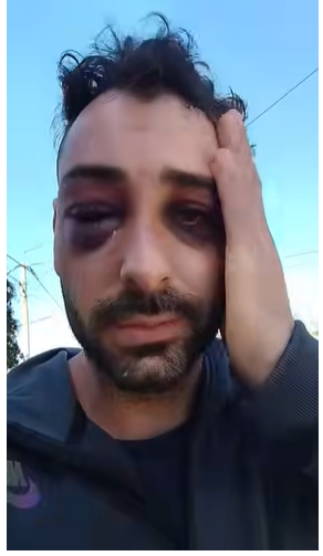 "No me mataron porque soy fuerte": lutier denunció salvaje golpiza policial