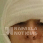 Una adolescente de 15 años fue atacada a cuchillazos por una patota: “La querían matar”