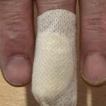 Un repartidor de Mercado Libre fue mordido por un Pitbull en Toay