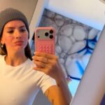 La China Suárez mostró los resultados tras realizarse un lifting en Turquía