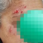 25 de Mayo: una mujer fue atacada por un perro en la calle