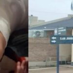 Brutal ataque de dos dogos a un adolescente: «Lo mordieron hasta en la cabeza, si no intervenía el vecino con un caño, me lo mataban»